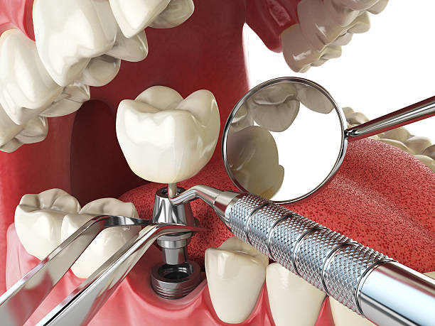 Best Urgent Tooth Repair  in Campbelltown, PA